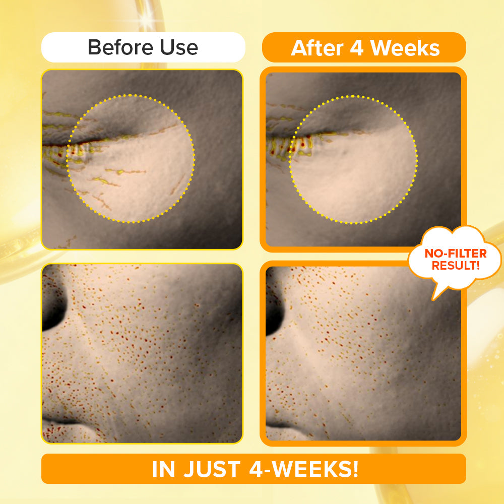 [Amazon Hot Selling🔥] Spicule Retinol PDRN Cream